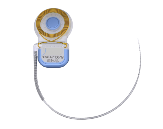 人工耳蜗植入体