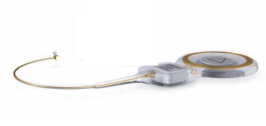 振动声桥植入体