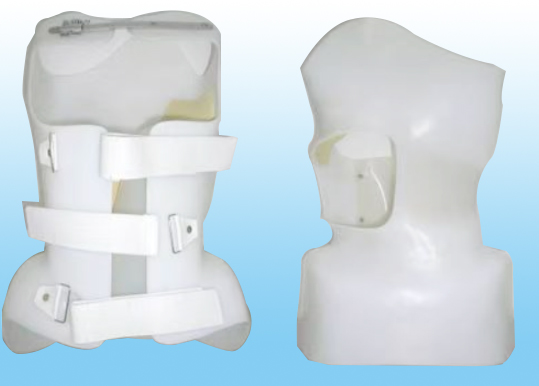 瑞思辅具&nbsp;侧弯矫形器&nbsp;定制型