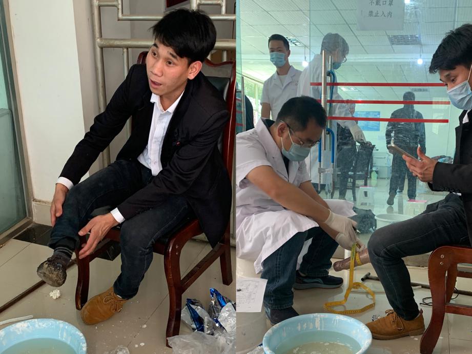 图为假肢技师正在为白日格取型